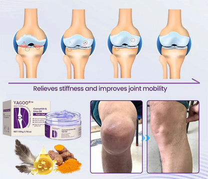 Yagoo® Curcumin & Emu Oil Pain Gel – 🏥Inspired by US Osteopathic Practices