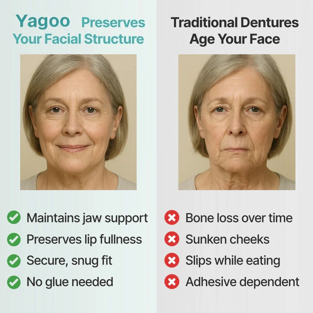 🦷Ends Today: 70% OFF! Yagoo® Custom-Fit Full Functional DenturesMake you more confident